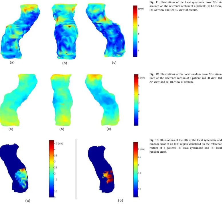 Fig. 12. Illustrations of the local random error SDs visua- visua-lized on the reference rectum of a patient: (a) LR view, (b) AP view and (c) RL view of rectum.