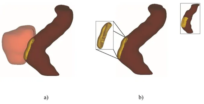Fig. 1.3 Visualizations of the ROP region of a patient at a fraction as determined by the radiation  oncologists: (a) shows the PTV (red), rectum (brown), and the ROP region (yellow) as viewed from  the LR direction, while (b) shows only the rectum and the