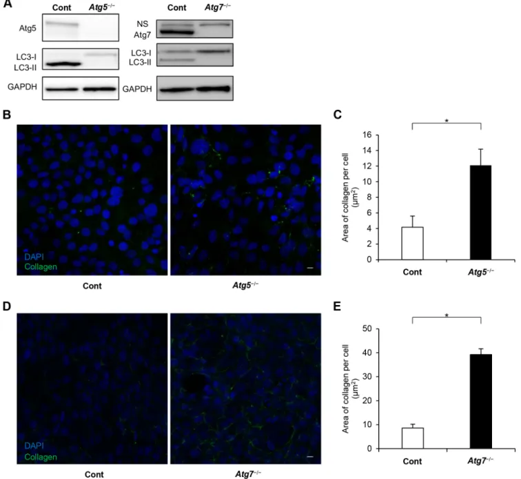 Fig. 2. Internalized collagen levels were higher in autophagy-deficient cells than in control cells