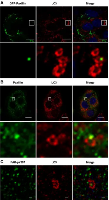Fig. 4. Autophagosomes associated with the internalized complexes of focal adhesion (FA) complex