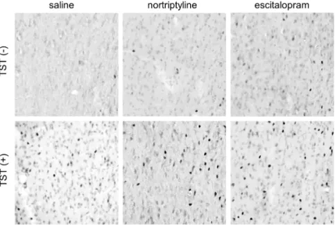 Fig. 2. Representative photomicrographs of c-Fos immunoreactivity in the intermediate part of the lateral septal nucleus obtained from the six experimental groups