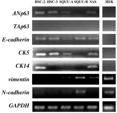 図 1 OSCC 細胞における EMT 関連分子の発現 （ A; RT-PCR, B; Western blotting ）    ΔNp63 は SQUU-B 細胞以外の OSCC 細胞において発現を認めた。また、 