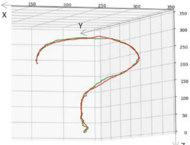 Fig. 8. Aorta extraction result by SRG. 