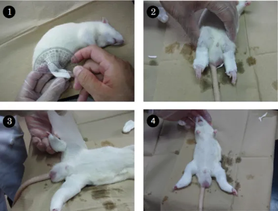 Figure 1. Immobiliozation using a plaster cast. 1) Adjustment of the ankle angle by a paper clay  splint