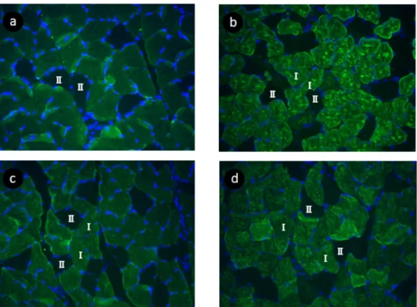 Figure 2. Serial transverse section of the soleus muscle of rat in the CON (a), IMM (b), RCON  (c), RCLE (d) groups