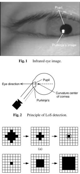 Fig. 3 Shrink and expansion operations.