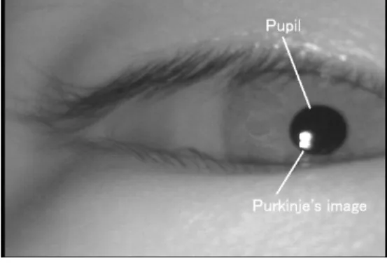 Figure 1 shows an example of infrared image of eye. Two