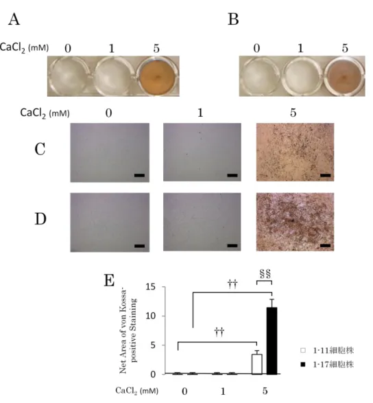 Figure 3.   カルシウム刺激を行ったヒト歯根膜細胞株における石灰化実験 1-11 細胞株（ A, C ）または 1-17 細胞株（ B, D ）をカルシウム刺激培地で培養 し、 4 週間後に von Kossa 染色を行った。 （ C ） （ D ）はそれぞれ（ A ） （ B ）の拡大 像を示す。 0 、 1 または 5mM の CaCl 2 にて刺激を行い、両細胞株の von Kossa 陽 性部位は scion imaging software を用いて定量解析を行った（ E ） 。両細胞株