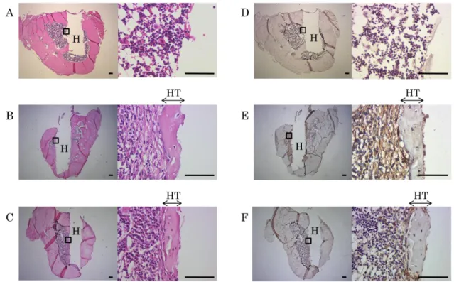Figure 6.   ヒト歯根膜前駆細胞株の骨内埋入による硬組織形成