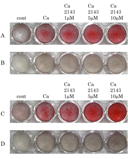 Figure 8. CaSR 拮抗薬がヒト歯根膜細胞株の石灰化に及ぼす影響 1-11 細胞株（ A, B ）または 1-17 細胞株（ C, D ）を、 10%FBS / -MEM 、カルシ ウム刺激培地、そしてカルシウム刺激培地に NPS2143 を 1 、 5 および 10M 添加 し、培養を行った。 14 日後、それぞれの細胞について Alizarin Red 染色（ A, C ） および von Kossa 染色（B, D）を行った。両細胞株ともに、NPS2143 の濃度依存 的に亢進した陽性像