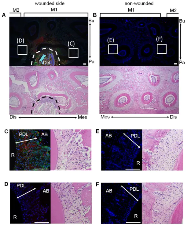 Figure  1.  傷害を与えたラット歯根膜組織における GDNF ならびに IL-1の免疫組織化学的染色法による 解析  左側を傷害側 (A, C, D)、右側を非傷害側 (B, E, F)とし、ラット上顎第一臼歯近心口蓋側の歯根および周 囲組織に傷害を与えて 72 時間後の GDNF の発現について、免疫組織化学的染色法を用いて解析を行った。 抗 GDNF 抗体  (赤)ならびに抗 IL-1抗体緑に対して、傷害側第一臼歯の創部近傍の歯根膜組織 (C)にお いて強陽性反応を認めた。これと比較