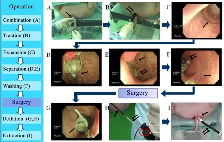 Figure 2. Use of the occlusion balloon during in vivo operations 