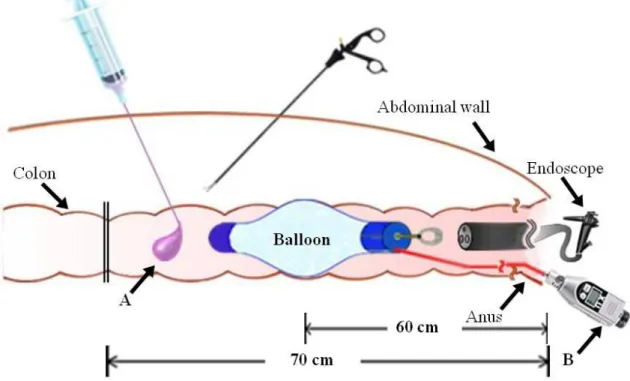 Figure 3. Balloon fluid leak test using methylene blue solution 
