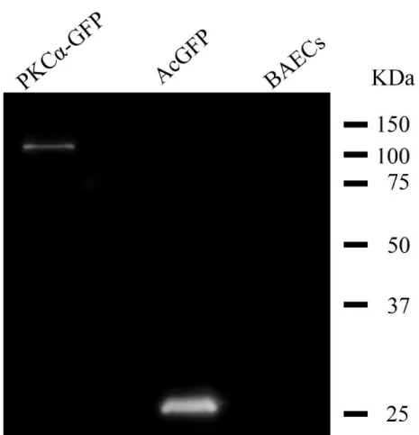 Fig. 4-2 1 次抗体に Anti-GFP を使用したウェスタン画像 