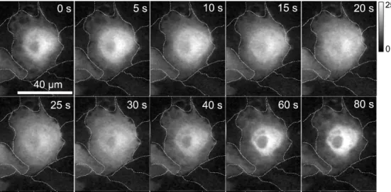 Fig. 4-7 ATP 負荷時の PKCα-GFP  輝度変化
