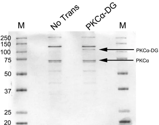 Fig. 5-1 1 次抗体に Anti-PKCα を使用したウェスタン画像
