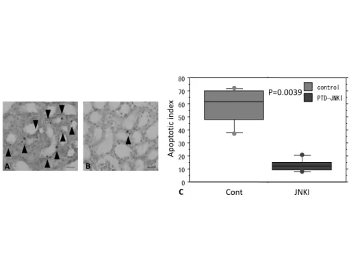 Figure 6. TUNEL stain at postoperative day five. A. In the control group, many apoptotic cells 