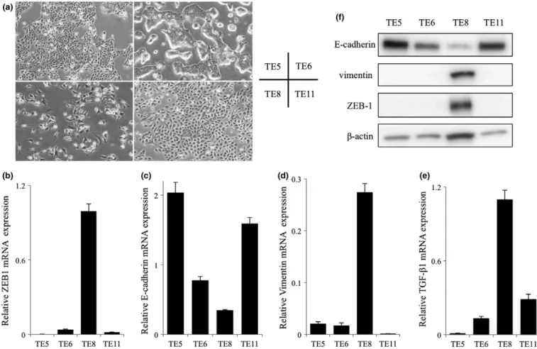 Fig. 3. Characteristics of the esophageal squamous cell carcinoma cell lines. (a) Morphological features of TE5, TE6, TE8 and TE11 cells