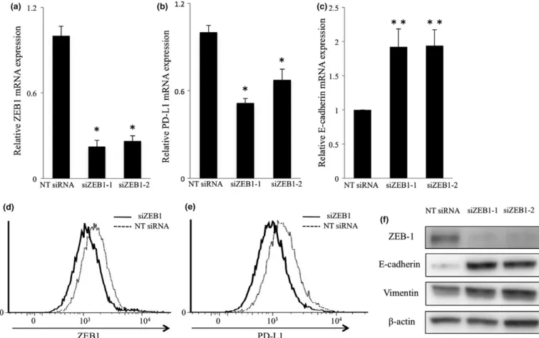 Fig. 4. Regulation of PD-L1 expression by ZEB1 in the TE8 cell line. TE8 cells were transfected by two different siRNAs directed against ZEB1 or nontargeting (NT) siRNA for 48 h and (a) ZEB1, (b) PD-L1 and (c) E-cadherin mRNA expression levels were examine