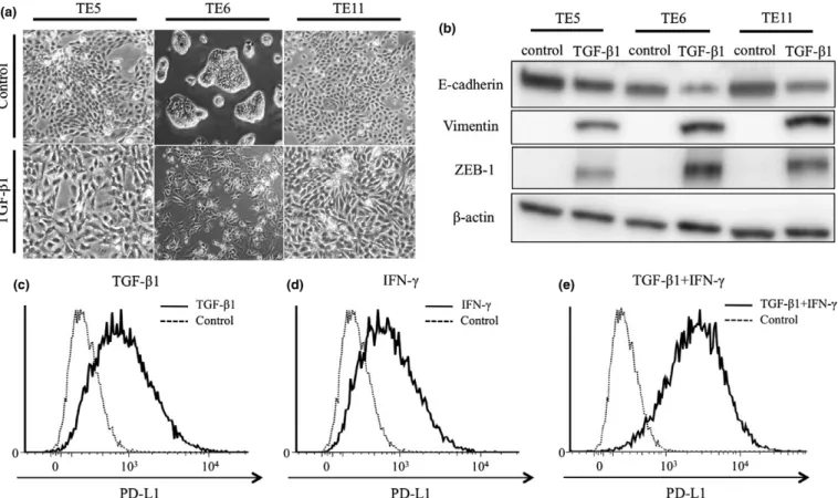 Fig. 5. ZEB1 and PD-L1 expression and morphological changes in esophageal squamous cell carcinoma cell lines induced by TGF- b 1