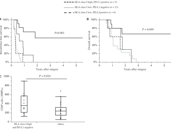 Fig. S7A) and overall survival (P = 0.584; Fig. S7B). When  patients were divided into four groups according to  mem-branous PD-  L1 and HLA class I expression, negative  membranous PD-  L1 expression and high HLA class I  expression by PDA (n = 14) was as