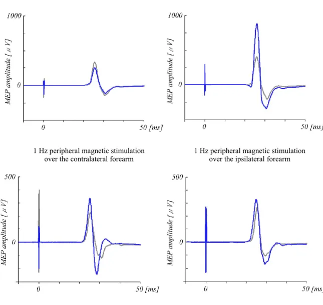 Figure 3-5 (A) The alteration of MEPs induced by peripheral magnetic stimulation over the  contralateral and ipsilateral forearm for left motor cortex in one subject