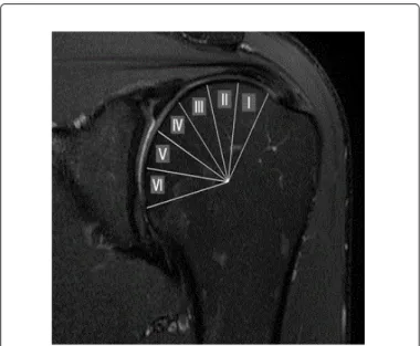 Figure 1: Six areas of the humeral head divided equally.