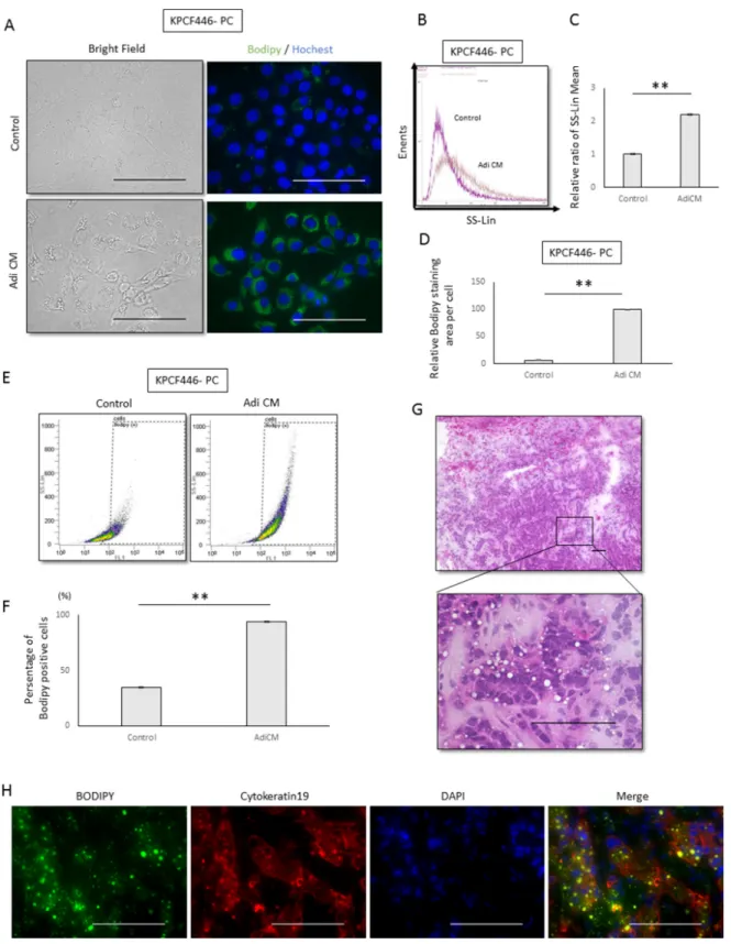 Figure 4: Effects of adipose tissue conditioned medium (Adi CM) on the morphology of pancreatic cancer cells