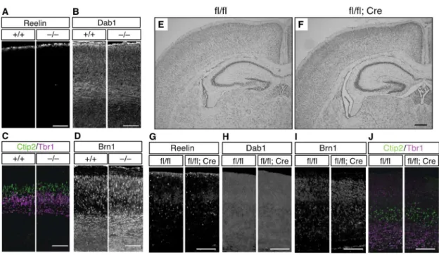 Figure 9. ADAMTS-3 欠損マウスの脳構造は概ね正常に形成される。