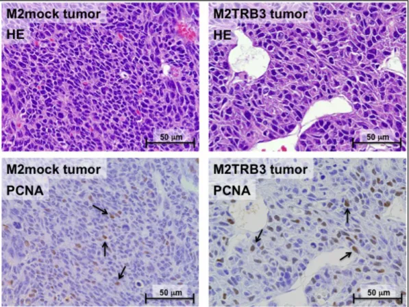 Fig.  6    Representative  histological  features  of  the  M2mock  (left  rows)  and  M2TRB3  tumors (right rows)