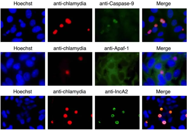 Fig.  9  Caspase-9,  but  not  Apaf-  1,  is  co-localized  with  inclusions  of  C. 
