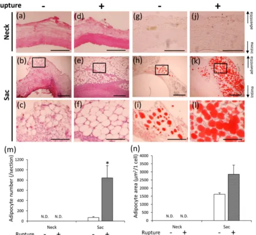 Figure 7 Adipocyte accumulation in non-ruptured and ruptured groups. (a-f) Representative  images of HE staining (a, c, d, f: scale bar = 200 µm; b, e: scale bar = 500 µm), and (g-l) Oil  Red O staining (g, j: scale bar = 100 µm; h, k: scale bar = 500 µm; 