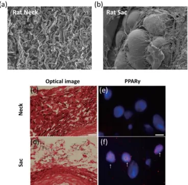 Figure 8 Observation of adipocyte and PPARγ staining. Representative electron microscopic  image of the vascular wall of the AAA neck (a) and sac (b) from a model rat