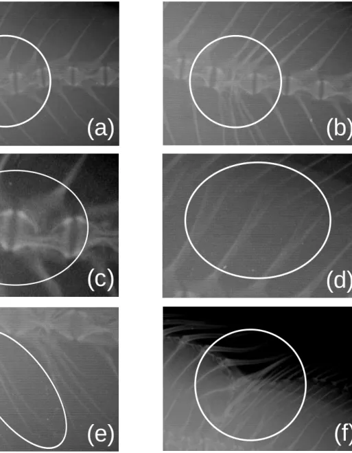 Fig.  Ⅱ-2. Types of malformation morphology in the seven-band grouper. The white  circles  indicate  the  abnormalities