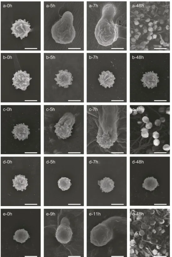 Fig. 19. Scanning electron microscope observations of  A. brasiliensis spores incubated at  28°C for 0, 5, 7, 9, 11 and 48 h