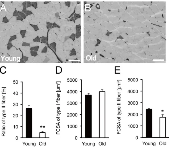 Fig.  1  Ratio of type II  fiber and fiber type-specific FCSA.  Cross sections  of soleus  muscle  were  stained  by  ATPase  staining  (pre-incubation  at  pH  10.7)  in  the  young  (A)  and older (B) rats