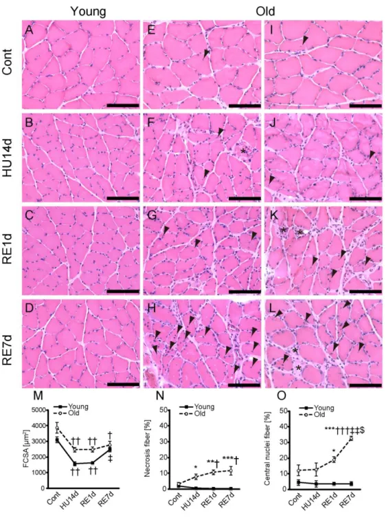 Fig.  3  FCSA and histopathologic findings.  Cross  sections of  the soleus muscle were  stained by HE in the young (A–D) and older (E–L) rats