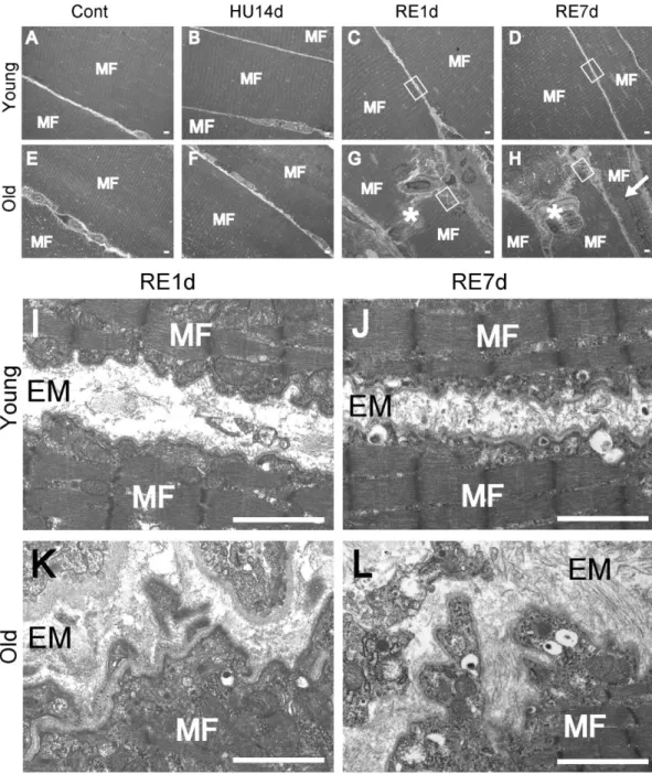 Fig. 4 Electron microscopy analysis. Longitudinal sections of the soleus muscle were 