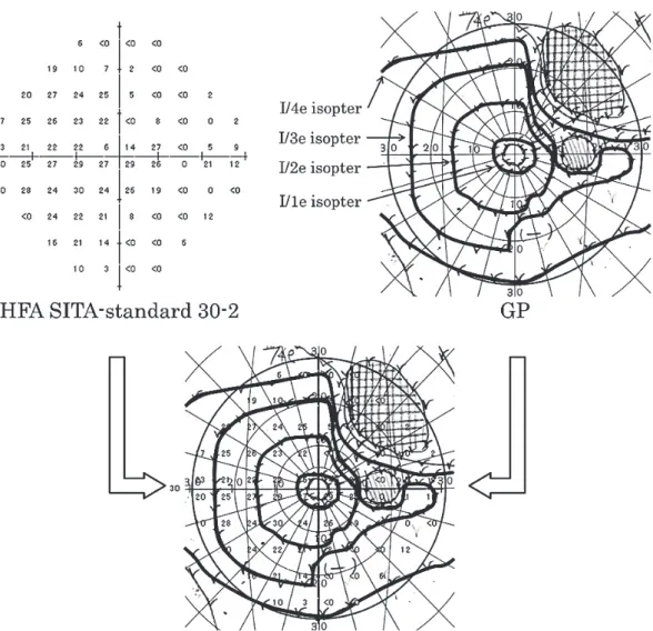 図 4 ． GP の I/4e ，I/3e ，I/2e ，I/1e イソプタと HFA の結果を重ね合わせ，30‐2 と比較する 場合は ±3° 以内，10‐2 と比較する場合は ±1° 以内に存在する静的閾値を鼻側視野，全 視野に分けて抽出した．