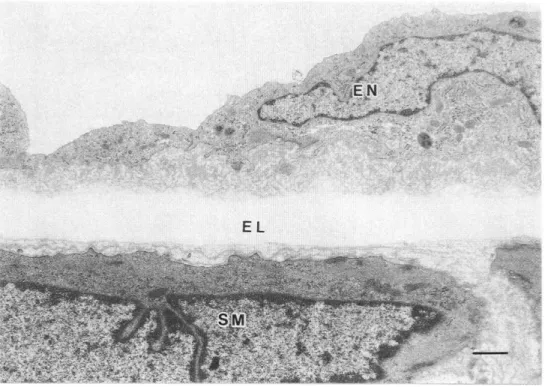 Fig.  2 Hepatic  artery  of  control  rat 