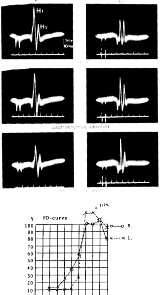 Fig.  7 Rigidity  patient,   27-   year-old  female 