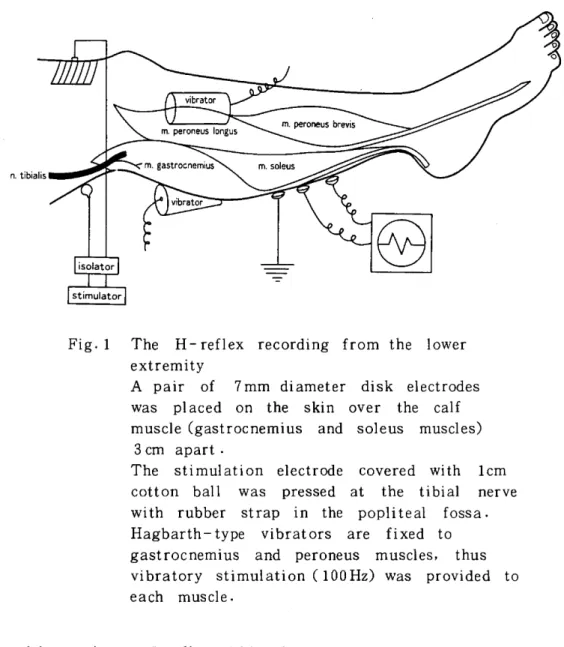Fig.  1 The  H-reflex  recording  from  the  lower  extremity 
