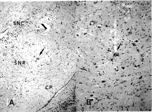 Fig. 1  Location of a recorded neuron in the SNR 