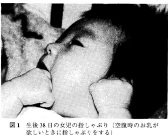 図 1  生後 38日 の女児 の指 しゃぶ り (空 腹 時 のお乳 が 欲 しい ときに指 しゃぶ りをす る ) あると思 う」 という。だから ,お 腹が空いているのではないか という。 山内によると ,指 しゃぶ りは新生児 とそれ以降ではその意味合いが違 うよ うである。新生児の吸啜反応 (国 のまわ りや唇 に触れたものに吸い付 く )は 把握反応 (手 の平 に指などを押 しつけると ,そ れを握 る )な どと並ぶ原始反 応の一つであるといわれている。 しか し新生児以降については ,行 