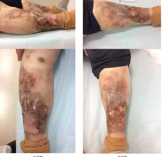 Figure 1   Preoperative both lower limb situation