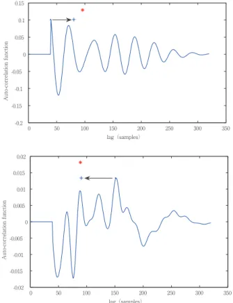 Figure 2   Examples of correcting an irregular pitch in case of halving  lag（upper）and  doubling  lag（bottom）