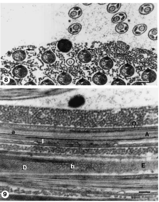 Fig. 8.Transverse section through seminal vesicle. Eupyrene spermatozoa remain in bundles and are embedded in a matrix of entangled electron-The upper ﬂagellum (a) displays axoneme (A) and inner (I) and outer (O) envelopes