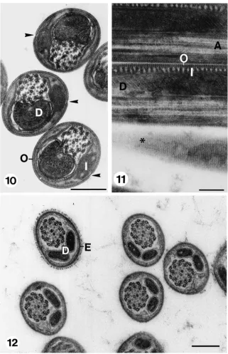 Fig. 10.Transverse sections through eupyrene spermatozoa in spermatheca. Note absence of both extra cellular matrix and reticular appendages.A longitudinal slit (arrows) in the outer envelope marks the location at which the reticular appendages bulged whil