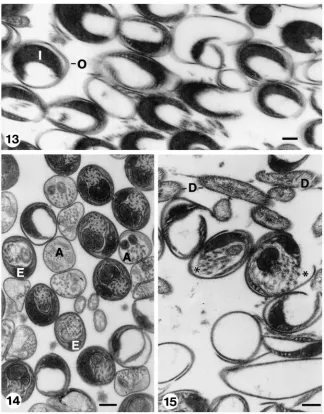Fig. 13.Spermatheca showing transverse sections of empty envelopes from which eupyrene spermatozoa “hatched”, before leaving spermathecaspermatozoa at their late stages of decay