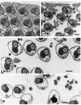Fig. 16.Transverse section through an eupyrene bundle from seminal vesicle, after incubation in clean HEPES buffer for 30 mins